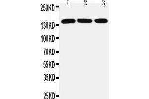 Anti-ATX2 antibody, Western blotting Lane 1: PANC Cell Lysate Lane 2: SMMC Cell Lysate Lane 3: HELA Cell Lysate (Ataxin 2 anticorps  (C-Term))