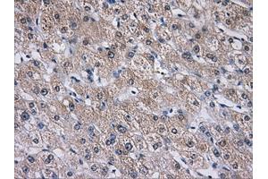 Immunohistochemistry (IHC) image for anti-Aldo-Keto Reductase Family 1, Member A1 (Aldehyde Reductase) (AKR1A1) antibody (ABIN1496541) (AKR1A1 anticorps)