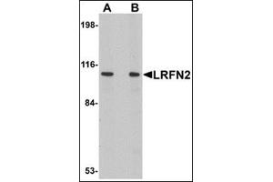 Western blot analysis of LRFN2 in rat brain lysate with this product at (A) 1 and (B) 2 μg/ml. (LRFN2 anticorps  (C-Term))