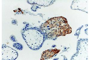 Immunohistochemistry staining with anti-human HLA-G (MEM-G/1). (HLAG anticorps)