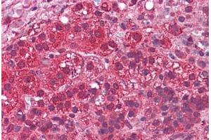 Human Adrenal: Formalin-Fixed, Paraffin-Embedded (FFPE)