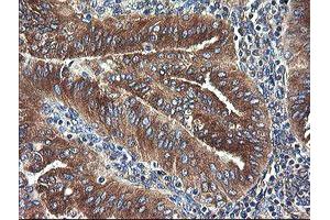 Image no. 13 for anti-Ubiquitin-Conjugating Enzyme E2, J1, U (UBE2J1) antibody (ABIN1501638)