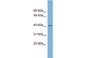WB Suggested Anti-TFDP3 Antibody Titration: 0. (TFDP3 anticorps  (Middle Region))