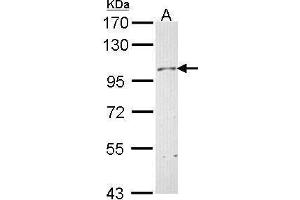 WB Image Sample (30 ug of whole cell lysate) A: Hela 7. (Neuropilin 1 anticorps  (C-Term))