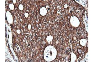 Image no. 6 for anti-Phosphatidylinositol-4-Phosphate 3-Kinase, Catalytic Subunit Type 2 beta (PIK3C2B) antibody (ABIN1500199)