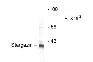 Western blots of rat synaptic membrane (SPM) showing specific immunolabeling of the ~ 36k stargazin protein. (Stargazin anticorps  (C-Term))