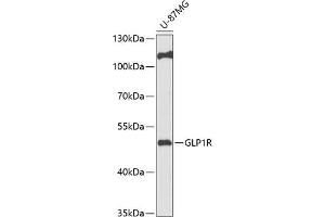 Western blot analysis of extracts of U-87MG cells, using GLP1R antibody (ABIN6131005, ABIN6141137, ABIN6141139 and ABIN6218185) at 1:1000 dilution. (GLP1R anticorps  (AA 22-116))