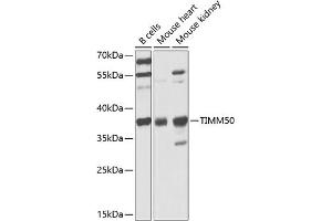 Western blot analysis of extracts of various cell lines, using TIMM50 antibody (ABIN6132725, ABIN6149170, ABIN6149171 and ABIN6225341) at 1:1000 dilution.