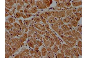 IHC image of ABIN7150096 diluted at 1:100 and staining in paraffin-embedded human heart tissue performed on a Leica BondTM system. (DIXDC1 anticorps  (AA 70-333))