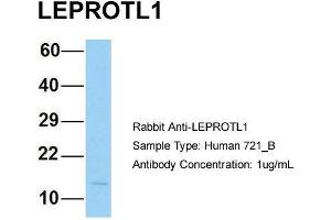 Host: Rabbit Target Name: LEPROTL1 Sample Type: Human 721_B Antibody Dilution: 1. (LEPROTL1 anticorps  (N-Term))