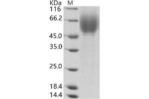 Western Blotting (WB) image for Hepatitis C Virus Envelope Protein E2 (HCV E2) protein (His tag) (ABIN7196080)