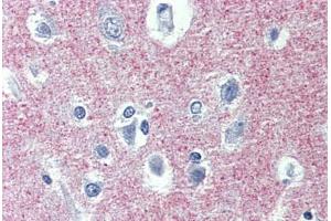 Human Brain, cortex: Formalin-Fixed, Paraffin-Embedded (FFPE)