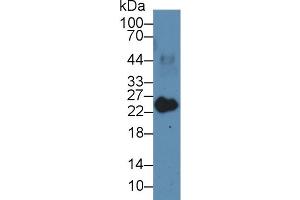 Western Blot; Sample: Porcine Heart lysate; Primary Ab: 3µg/ml Rabbit Anti-Human MYL3 Antibody Second Ab: 0. (MYL3/CMLC1 anticorps  (AA 5-181))