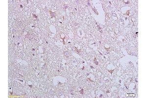 Formalin-fixed and paraffin embedded: rat brain tissue labeled with Anti-Bax Polyclonal Antibody, Unconjugated  at 1:800 followed by conjugation to the secondary antibody and DAB staining