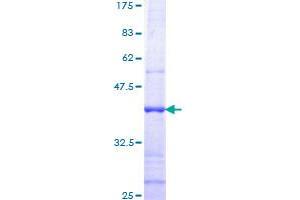 Image no. 1 for Transmembrane Protease, serine 2 (TMPRSS2) (AA 383-492) protein (GST tag) (ABIN1323092)