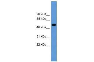 Western Blot showing PSEN1 antibody used at a concentration of 1-2 ug/ml to detect its target protein. (Presenilin 1 anticorps  (Middle Region))