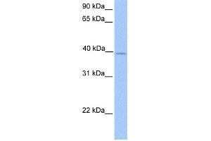 WB Suggested Anti-ZFP92 Antibody Titration:  0. (ZNF92 anticorps  (Middle Region))