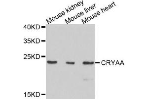 Western blot analysis of extracts of mouse tissues, using CRYAA antibody. (CRYAA anticorps)