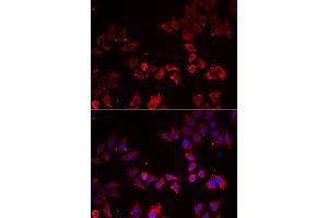 Immunofluorescence analysis of A549 cell using LIMS1 antibody. (LIMS1 anticorps)