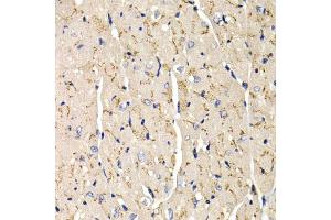 Immunohistochemistry of paraffin-embedded mouse heart using SFRP2 antibody (ABIN5973117) at dilution of 1/200 (40x lens). (SFRP2 anticorps)