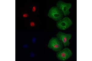 NUCL Antibody staining Hela cells by IF/ICC. (Nucleolin anticorps  (Internal Region))