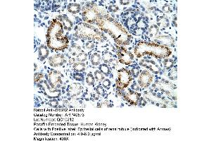 Rabbit Anti-ZESR2 Antibody  Paraffin Embedded Tissue: Human Kidney Cellular Data: Epithelial cells of renal tubule Antibody Concentration: 4.
