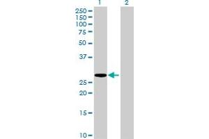 Western Blot analysis of HLA-DMA expression in transfected 293T cell line by HLA-DMA MaxPab polyclonal antibody. (HLA-DMA anticorps  (AA 1-261))