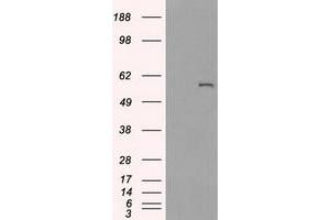 HEK293T cells were transfected with the pCMV6-ENTRY control (Left lane) or pCMV6-ENTRY CYP2E1 (Right lane) cDNA for 48 hrs and lysed.