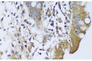 Immunohistochemistry of paraffin-embedded Human colon using GCN1L1 Polyclonal Antibody at dilution of 1:150 (40x lens). (GCN1L1 anticorps)
