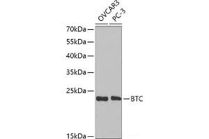 Western blot analysis of extracts of various cell lines using BTC Polyclonal Antibody at dilution of 1:1000. (Betacellulin anticorps)