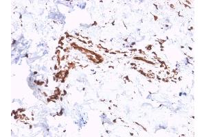 Formalin-fixed, paraffin-embedded human Skin stained with Collagen VII Mouse Monoclonal Antibody (LH7. (COL7A1 anticorps)