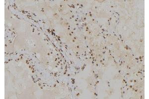 ABIN6279359 at 1/100 staining Human lung tissue by IHC-P.
