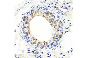 Immunohistochemistry of paraffin-embedded mouse lung using ENDOG antibody (ABIN5997672) at dilution of 1/100 (40x lens). (Endonuclease G anticorps)