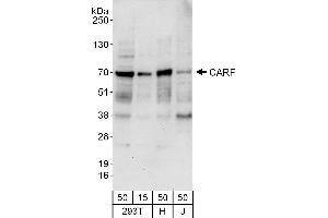 Western Blotting (WB) image for anti-CDKN2A Interacting Protein (CDKN2AIP) (AA 225-275) antibody (ABIN7449690)