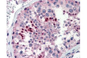 Anti-DAX1 antibody IHC of human testis.