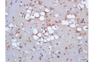 Formalin-fixed and paraffin embedded rat brain labeled with Anti-ZNRF3 Polyclonal Antibody, Unconjugated  at 1:200 followed by conjugation to the secondary antibody and DAB staining (ZNRF3 anticorps  (AA 120-165))