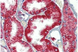 Kidney, Human: Formalin-Fixed, Paraffin-Embedded (FFPE)