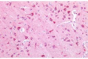 Immunohistochemistry of paraffin-embedded Human adrenal tissue using NPTX1 Polyclonal Antibody at dilution of 1:100. (NPX1 anticorps)