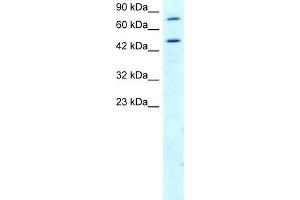 WB Suggested Anti-RGS9 Antibody Titration:  2. (RGS anticorps  (N-Term))