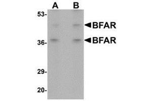 Western blot analysis of BFAR in human kidney tissue lysate with AP30141PU-N BFAR antibody at (A) 1 and (B) 2 μg/ml. (BFAR anticorps  (C-Term))