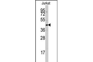 Western blot analysis of PTPN7 polyclonal antibody  in Jurkat cell line lysates (35 ug/lane). (PTPN7 anticorps  (Ser44))