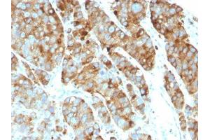 Image no. 1 for anti-CD63 (CD63) antibody (ABIN6187977) (CD63 anticorps)