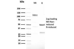 SDS-PAGE Analysis Purified G-CSF Recombinant Rabbit Monoclonal Antibody (CSF3/3166R).
