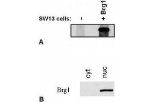 Western Blotting (WB) image for anti-SWI/SNF Related, Matrix Associated, Actin Dependent Regulator of Chromatin, Subfamily A, Member 4 (SMARCA4) (C-Term) antibody (ABIN614772) (SMARCA4 anticorps  (C-Term))