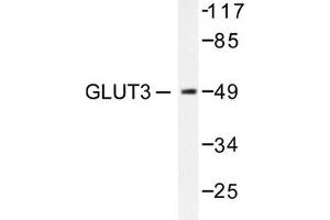 Image no. 1 for anti-Solute Carrier Family 2 (Facilitated Glucose Transporter), Member 3 (SLC2A3) antibody (ABIN265443) (SLC2A3 anticorps)