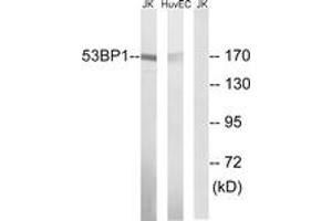 Western blot analysis of extracts from Jurkat/HuvEc cells, using 53BP1 (Ab-29) Antibody. (TP53BP1 anticorps  (AA 14-63))