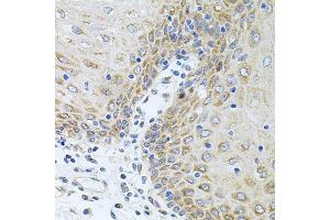 Immunohistochemistry of paraffin-embedded human esophagus using CPM antibody (ABIN6128978, ABIN6138956, ABIN6138957 and ABIN6222238) at dilution of 1:100 (40x lens). (CPM anticorps  (AA 204-443))