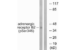 Immunohistochemistry analysis of paraffin-embedded human brain tissue using Adrenergic Receptor β2 (Phospho-Ser346) antibody. (beta 2 Adrenergic Receptor anticorps  (pSer346))