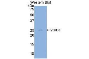 Detection of Recombinant ANGPTL8, Human using Polyclonal Antibody to Angiopoietin Like Protein 8 (ANGPTL8) (C19ORF80 anticorps  (AA 24-196))