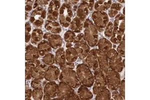 Immunohistochemistry (Formalin/PFA-fixed paraffin-embedded sections) of human stomach with TXNDC4 polyclonal antibody  shows strong cytoplasmic positivity in glandular cells.